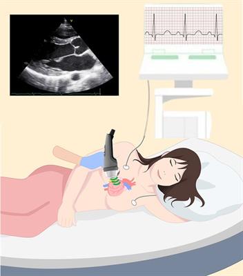 A prospective randomized controlled trial to determine the safety and efficacy of extracorporeal shock waves therapy for primary prevention of subclinical cardiotoxicity in breast cancer patients without a cardiovascular risk treated with doxorubicin